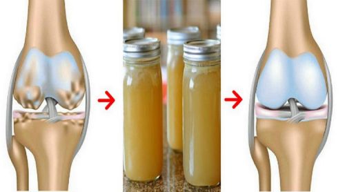 Homemade Remedy For Bone and Joint Health Restoration